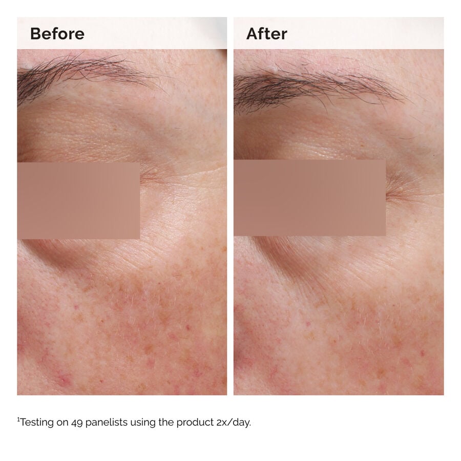 Niacinamide 5% Face and Body Emulsion - US 1183