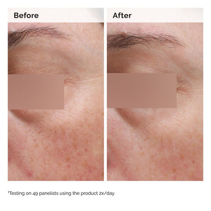 Niacinamide 5% Face and Body Emulsion - US 1183