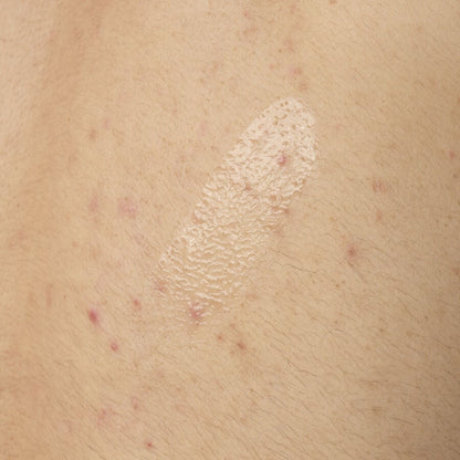 Salicylic Acid 0.5% Body Serum - US 7362