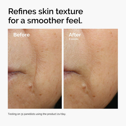 Caffeine 3% + Escin 1% Face Serum - US 2767