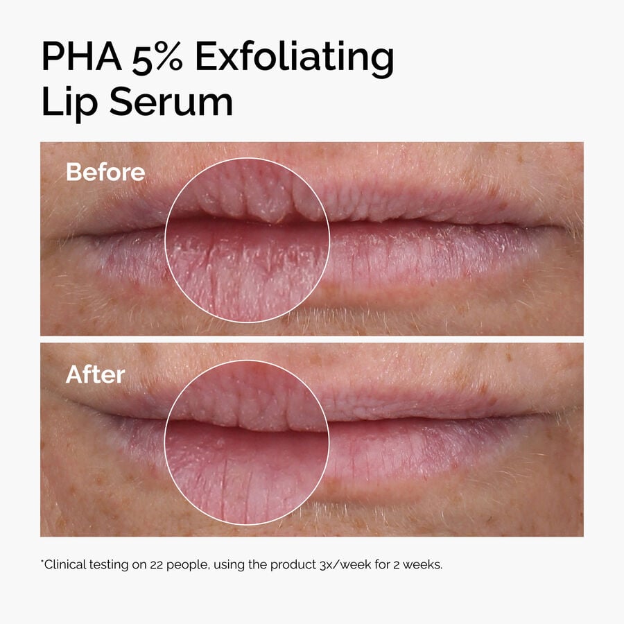 PHA 5% Exfoliating Lip Serum - US 2831