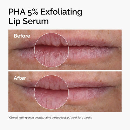 PHA 5% Exfoliating Lip Serum - US 2831